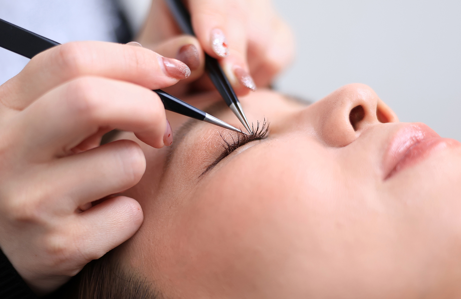 アイケア施術風景